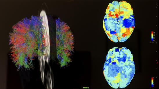 Forget Polygraphs. Brain-Scan Lie Detectors Are Coming