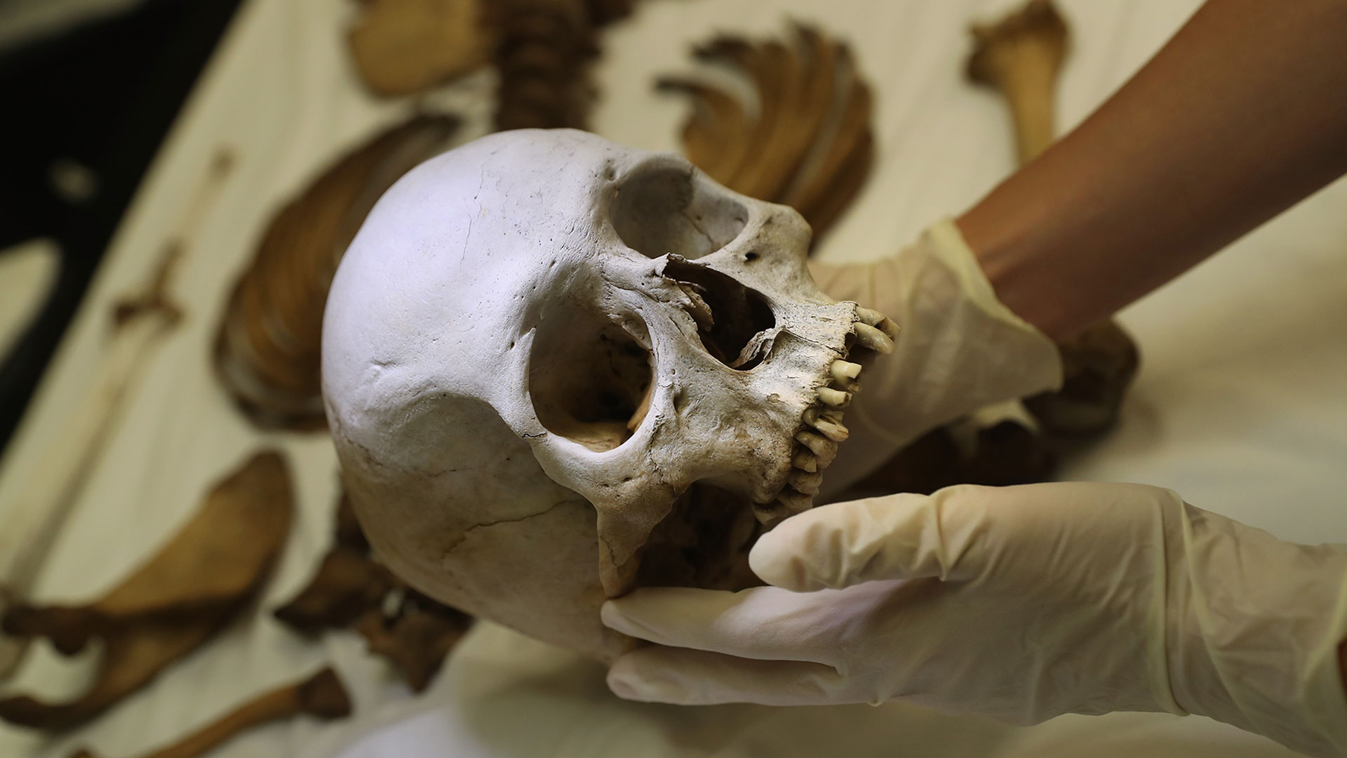 What Bones Can Tell Us About Crimes