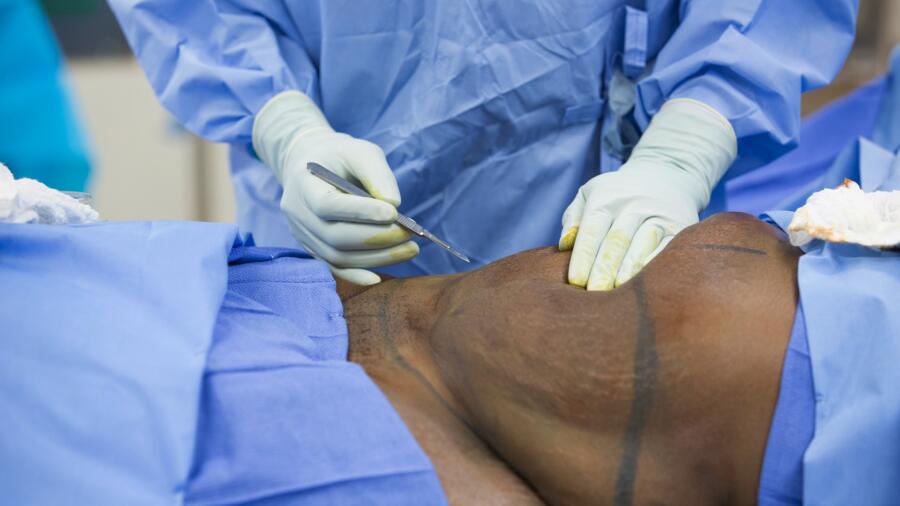 Atlanta Plastic Season 1