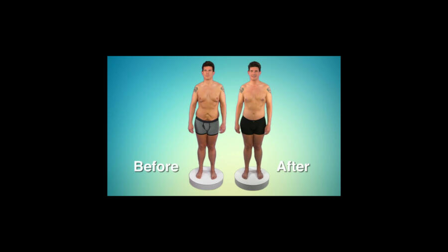 Atlanta Plastic Season 1 Before & After