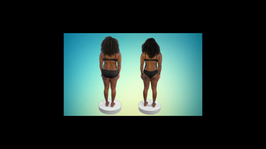 Atlanta Plastic Season 1 Before & After