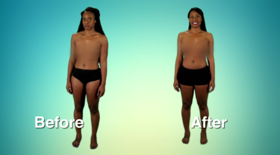 Atlanta Plastic Season 2 Before and After