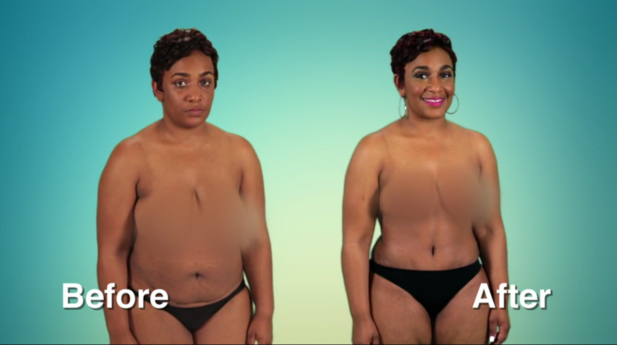 Atlanta Plastic Season 2 Before and After