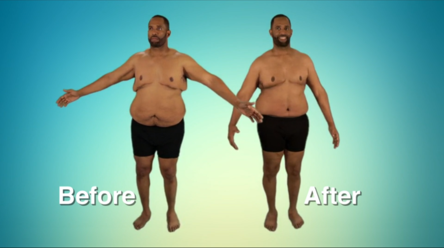 Atlanta Plastic Season 2 Before and After