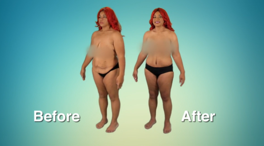 Atlanta Plastic Season 2 Before and After