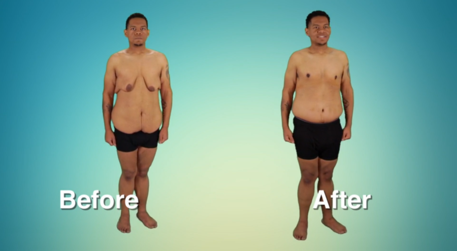 Atlanta Plastic Season 2 Before and After