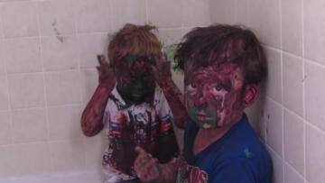 Episode 4 Shock and Awww