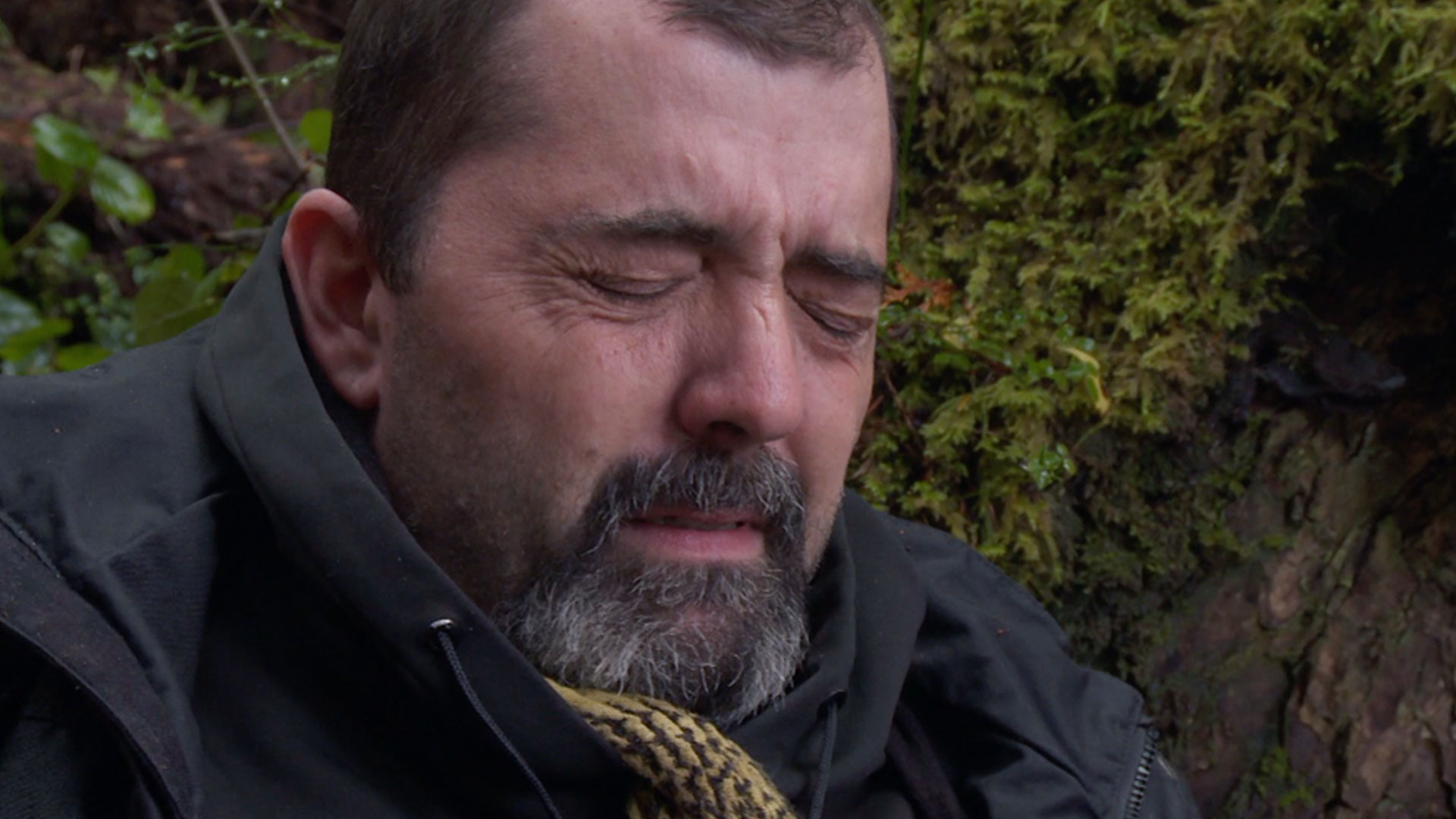 Shannon's Back Injury Results in Extraction thumbnail