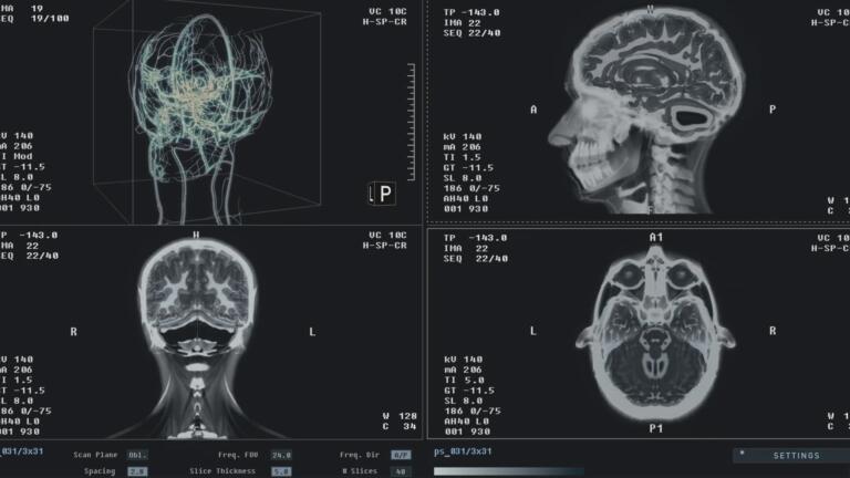 Havana Syndrome: The Truth Revealed thumbnail