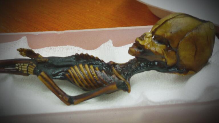 Ancient Body Discoveries Lift thumbnail