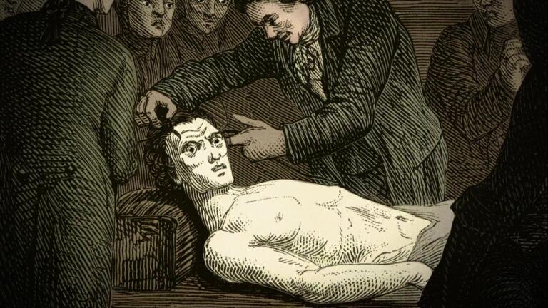 Did Scientists Really Reanimate the Dead? thumbnail